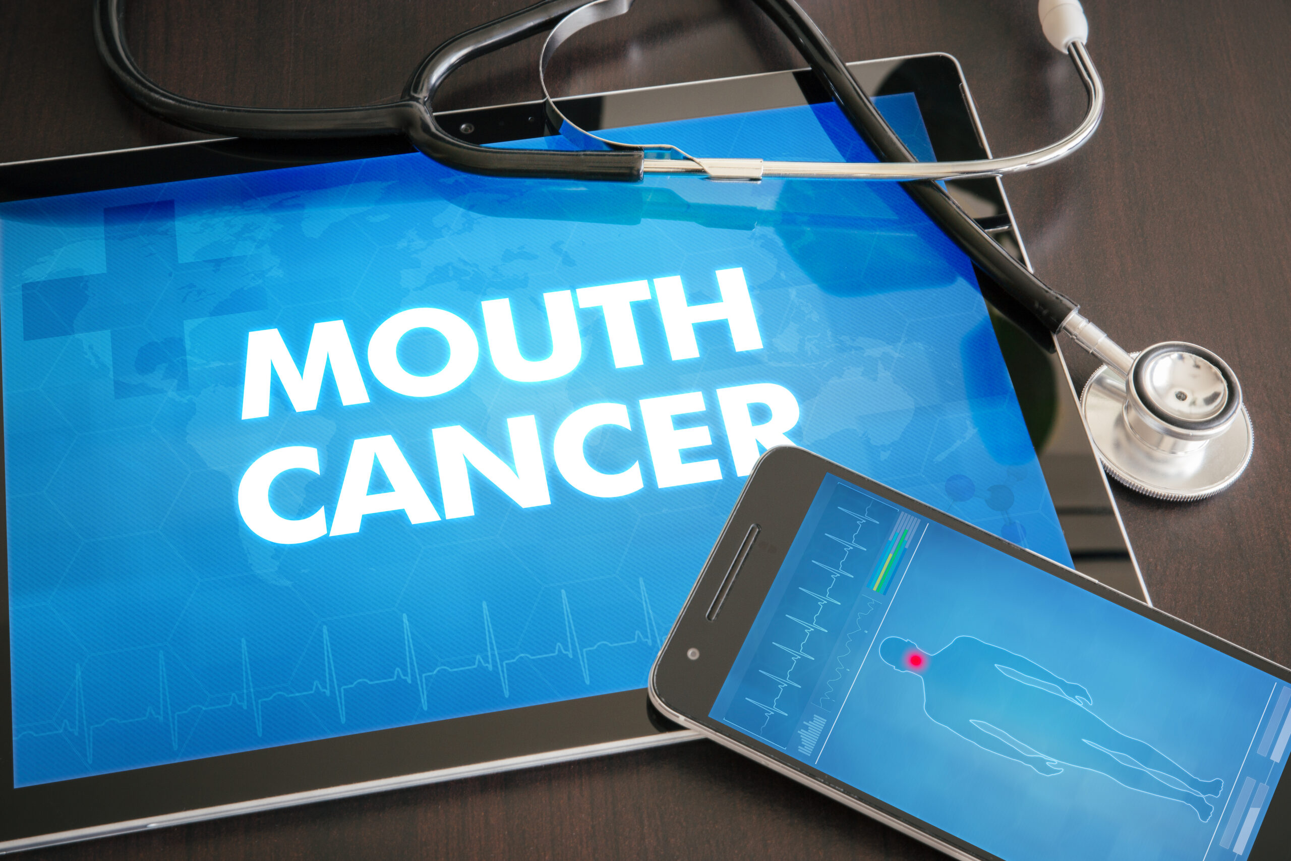 Mouth cancer (cancer type) diagnosis medical concept on tablet screen with stethoscope.