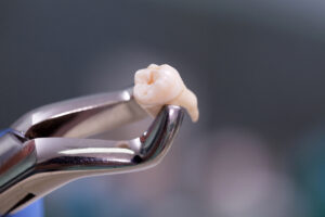 Dental equipment holding an extracted tooth