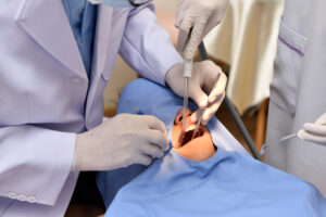 Oral Surgery