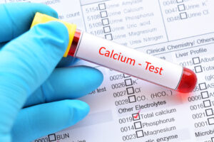 Calcium NPB CA