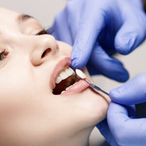 newport beach cosmetic dentistry