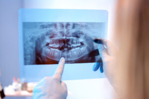 newport beach oral surgery