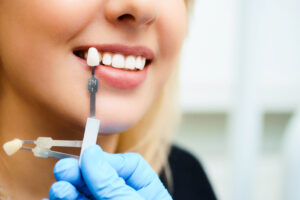 newport beach cosmetic dentistry