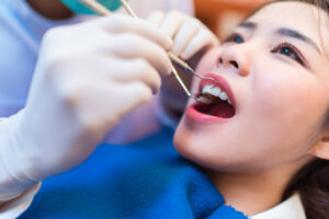 newport beach bone grafting