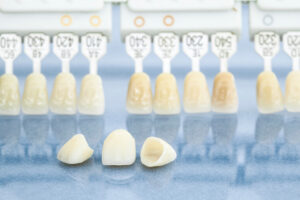 newport beach ceramic crown