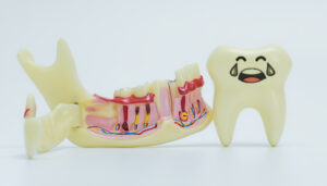 newport beach oral pathology